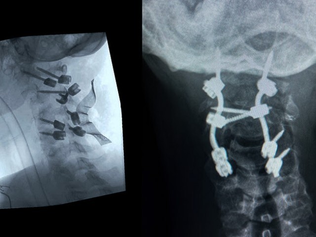 Monday Motivation: Make or Break | The Douglas Vieira Documentary