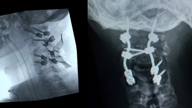 Monday Motivation: Make or Break | The Douglas Vieira Documentary