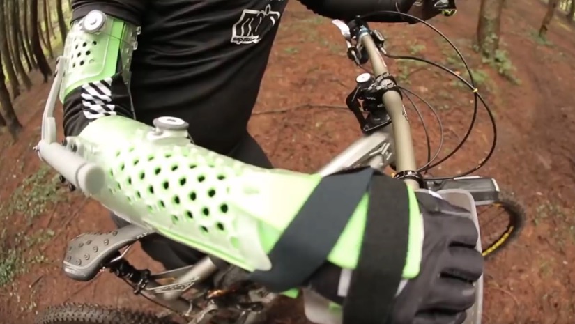 3D Printed Riding Arm Brace | The Story