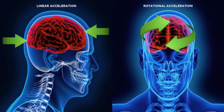 Kali Protectives: Rotational Concussions and LDL